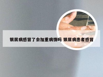银屑病感冒了会加重病情吗 银屑病患者感冒