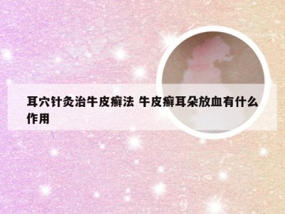 耳穴针灸治牛皮癣法 牛皮癣耳朵放血有什么作用