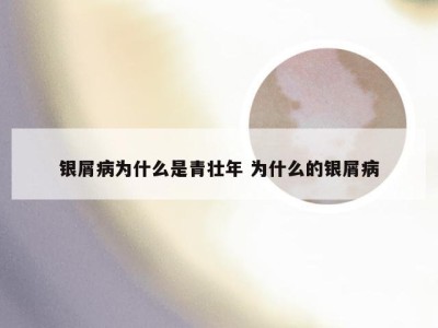 银屑病为什么是青壮年 为什么的银屑病