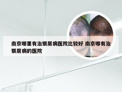 南京哪里有治银屑病医院比较好 南京哪有治银屑病的医院