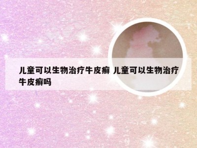 儿童可以生物治疗牛皮癣 儿童可以生物治疗牛皮癣吗
