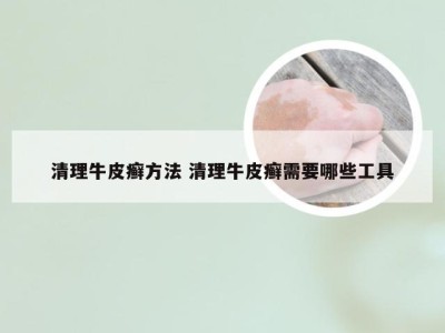 清理牛皮癣方法 清理牛皮癣需要哪些工具