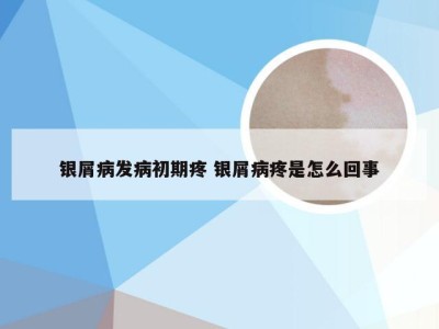 银屑病发病初期疼 银屑病疼是怎么回事