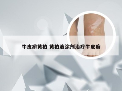 牛皮癣黄柏 黄柏液涂剂治疗牛皮癣