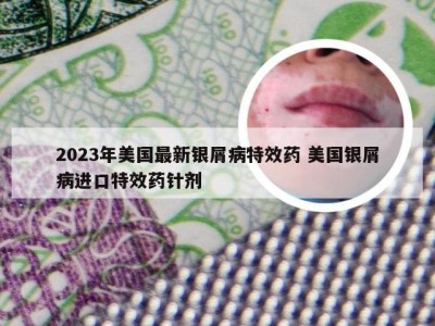 2023年美国最新银屑病特效药 美国银屑病进口特效药针剂