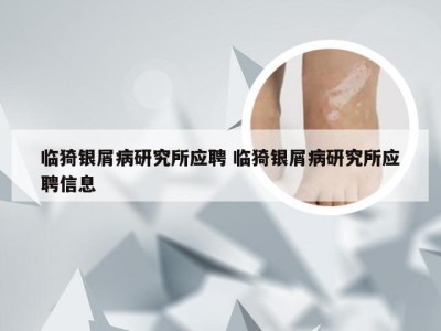 临猗银屑病研究所应聘 临猗银屑病研究所应聘信息