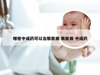 哪些中成药可以治银屑病 银屑病 中成药