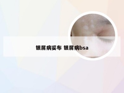 银屑病妥布 银屑病bsa