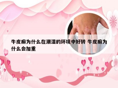 牛皮癣为什么在潮湿的环境中好转 牛皮癣为什么会加重