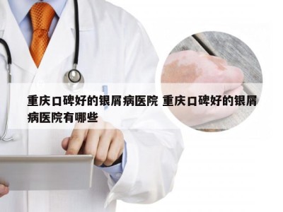 重庆口碑好的银屑病医院 重庆口碑好的银屑病医院有哪些