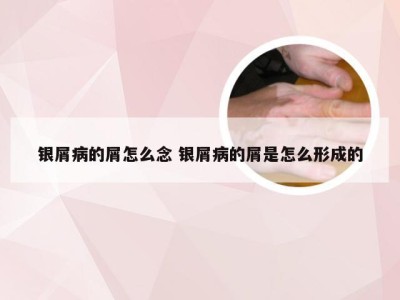 银屑病的屑怎么念 银屑病的屑是怎么形成的
