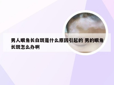 男人眼角长白斑是什么原因引起的 男的眼角长斑怎么办啊