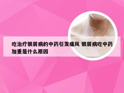 吃治疗银屑病的中药引发痛风 银屑病吃中药加重是什么原因