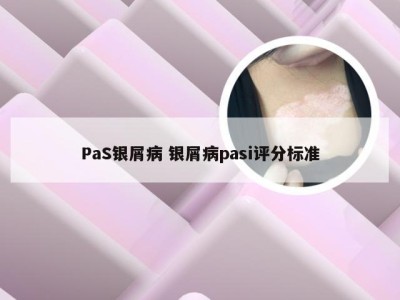 PaS银屑病 银屑病pasi评分标准