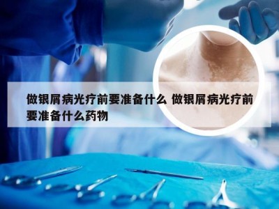 做银屑病光疗前要准备什么 做银屑病光疗前要准备什么药物