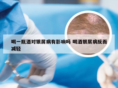 喝一瓶酒对银屑病有影响吗 喝酒银屑病反而减轻