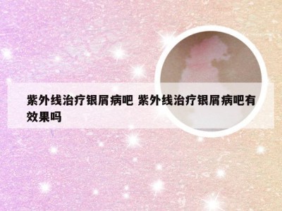 紫外线治疗银屑病吧 紫外线治疗银屑病吧有效果吗