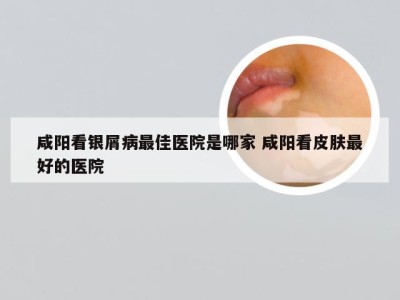 咸阳看银屑病最佳医院是哪家 咸阳看皮肤最好的医院