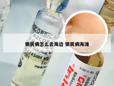 银屑病怎么去海边 银屑病海滩