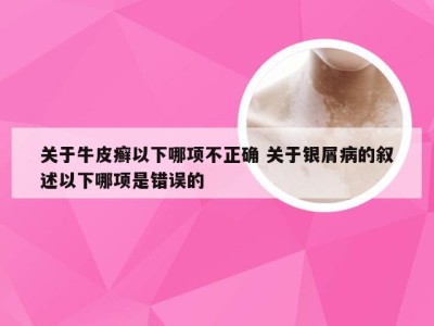 关于牛皮癣以下哪项不正确 关于银屑病的叙述以下哪项是错误的