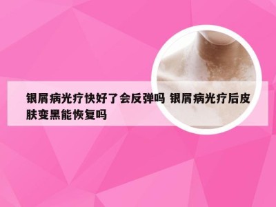 银屑病光疗快好了会反弹吗 银屑病光疗后皮肤变黑能恢复吗