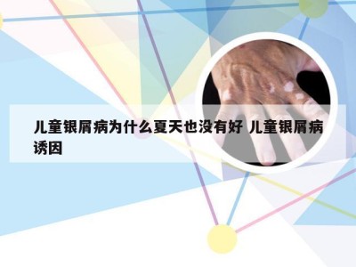 儿童银屑病为什么夏天也没有好 儿童银屑病诱因