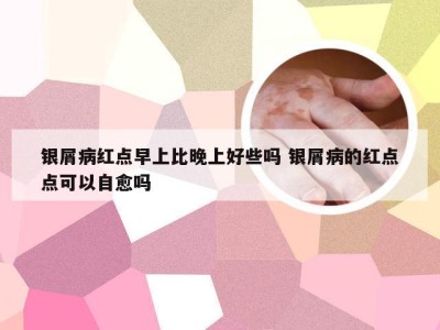 银屑病红点早上比晚上好些吗 银屑病的红点点可以自愈吗
