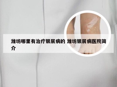 潍坊哪里有治疗银屑病的 潍坊银屑病医院简介