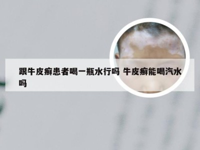 跟牛皮癣患者喝一瓶水行吗 牛皮癣能喝汽水吗