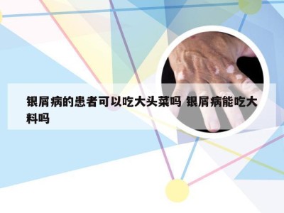 银屑病的患者可以吃大头菜吗 银屑病能吃大料吗