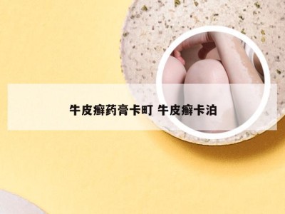 牛皮癣药膏卡町 牛皮癣卡泊