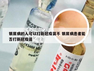 银屑病的人可以打新冠疫苗不 银屑病患者能否打新冠疫苗