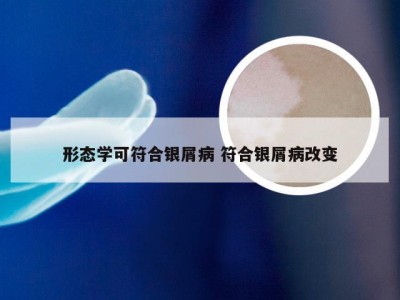 形态学可符合银屑病 符合银屑病改变