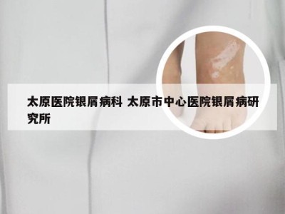 太原医院银屑病科 太原市中心医院银屑病研究所