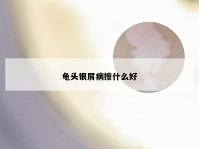龟头银屑病擦什么好