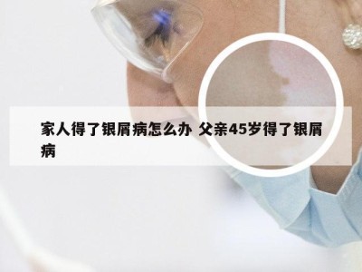 家人得了银屑病怎么办 父亲45岁得了银屑病