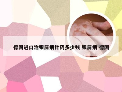 德国进口治银屑病针药多少钱 银屑病 德国
