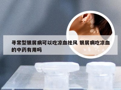 寻常型银屑病可以吃凉血祛风 银屑病吃凉血的中药有用吗