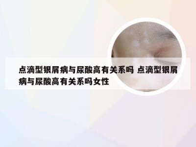 点滴型银屑病与尿酸高有关系吗 点滴型银屑病与尿酸高有关系吗女性