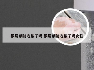 银屑病能吃梨子吗 银屑病能吃梨子吗女性