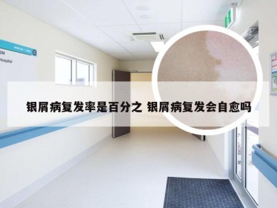 银屑病复发率是百分之 银屑病复发会自愈吗