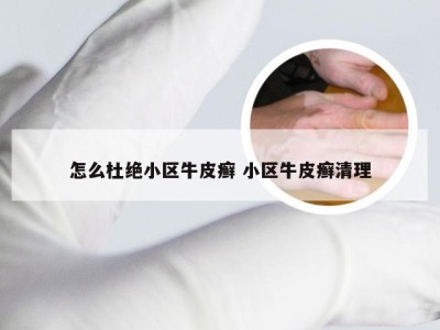 怎么杜绝小区牛皮癣 小区牛皮癣清理