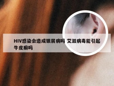 HIV感染会造成银屑病吗 艾滋病毒能引起牛皮癣吗