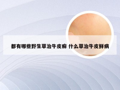 都有哪些野生草治牛皮癣 什么草治牛皮鲜病