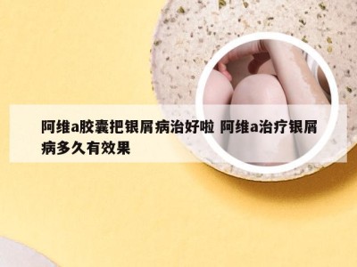 阿维a胶囊把银屑病治好啦 阿维a治疗银屑病多久有效果