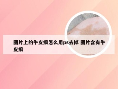 图片上的牛皮癣怎么用ps去掉 图片含有牛皮癣