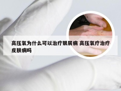 高压氧为什么可以治疗银屑病 高压氧疗治疗皮肤病吗