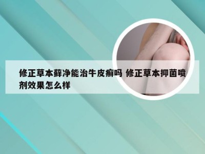修正草本藓净能治牛皮癣吗 修正草本抑菌喷剂效果怎么样