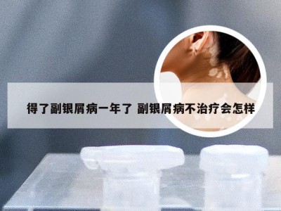 得了副银屑病一年了 副银屑病不治疗会怎样