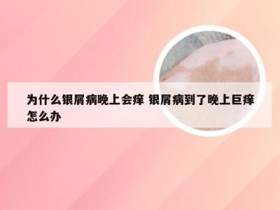 为什么银屑病晚上会痒 银屑病到了晚上巨痒怎么办
